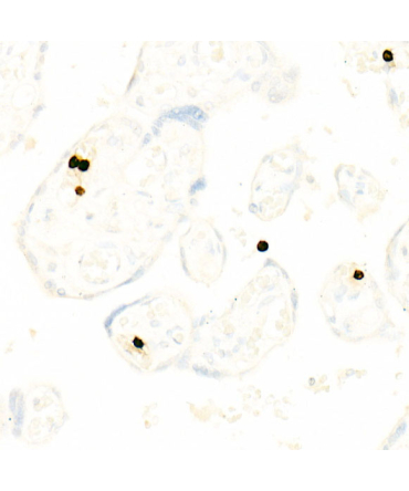 CD66b/CEACAM8 Rabbit Monoclonal Antibody