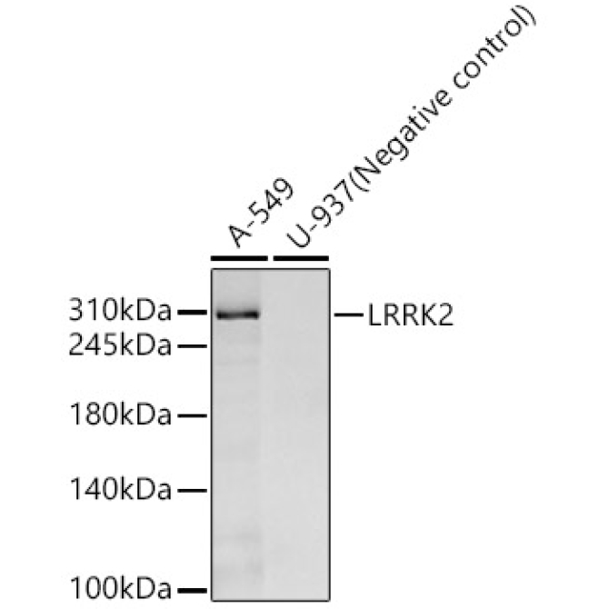 LRRK2 Rabbit Monoclonal Antibody