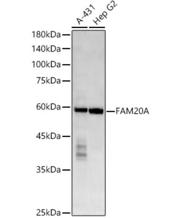 FAM20A Rabbit Monoclonal Antibody