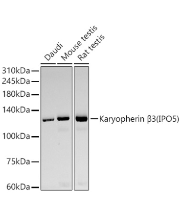 Karyopherin Beta3 (IPO5) Rabbit Monoclonal Antibody
