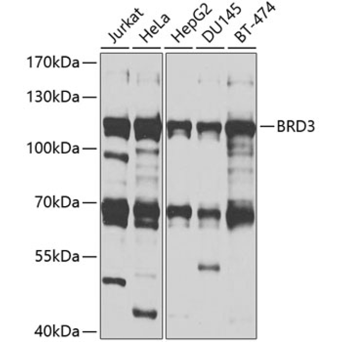 BRD3 Rabbit Polyclonal Antibody