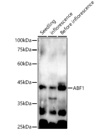 ABF1 Rabbit Polyclonal Antibody
