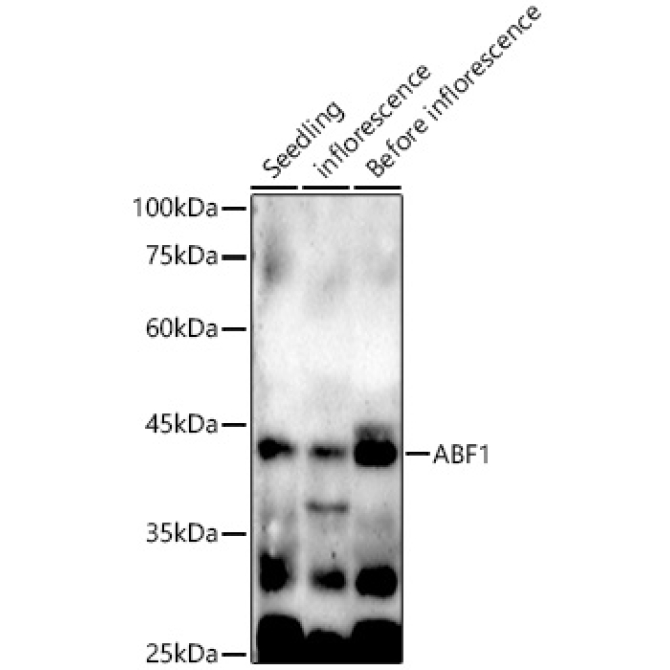 ABF1 Rabbit Polyclonal Antibody
