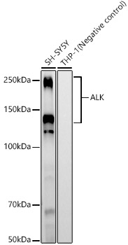 ALK Rabbit Monoclonal Antibody