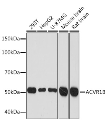ACVR1B Rabbit Monoclonal Antibody