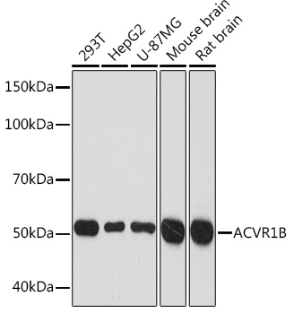 ACVR1B Rabbit Monoclonal Antibody