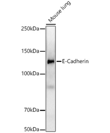 E-Cadherin Rabbit Monoclonal Antibody