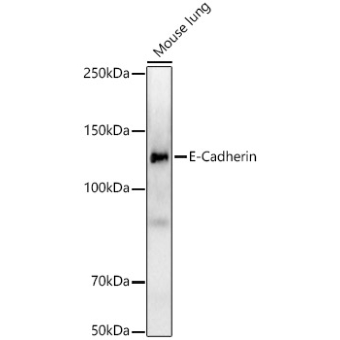 E-Cadherin Rabbit Monoclonal Antibody