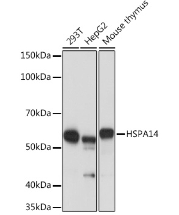 HSPA14 Rabbit Monoclonal Antibody