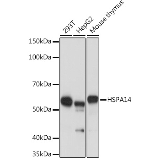 HSPA14 Rabbit Monoclonal Antibody
