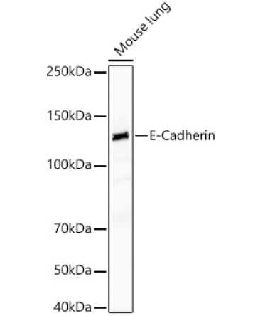 E-Cadherin Rabbit PolyMonoclonal Antibody?