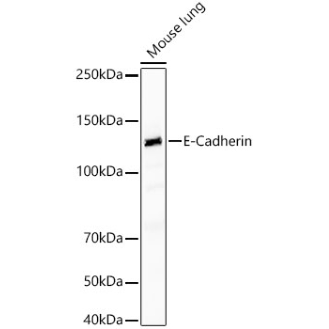 E-Cadherin Rabbit PolyMonoclonal Antibody?