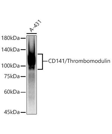 CD141/Thrombomodulin Rabbit PolyMonoclonal Antibody?