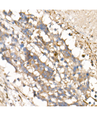 IL15 Rabbit Monoclonal Antibody
