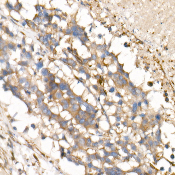 IL15 Rabbit Monoclonal Antibody