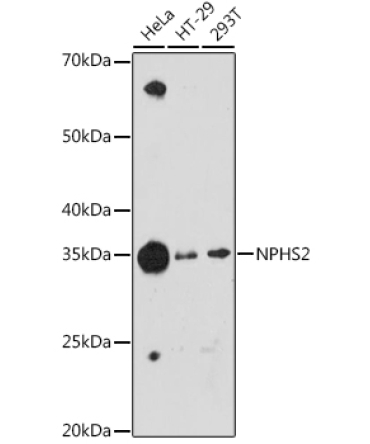 NPHS2 Rabbit Monoclonal Antibody