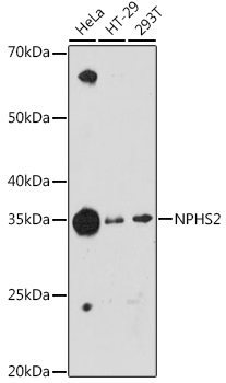 NPHS2 Rabbit Monoclonal Antibody