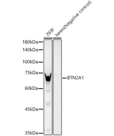 BTN2A1 Rabbit Monoclonal Antibody