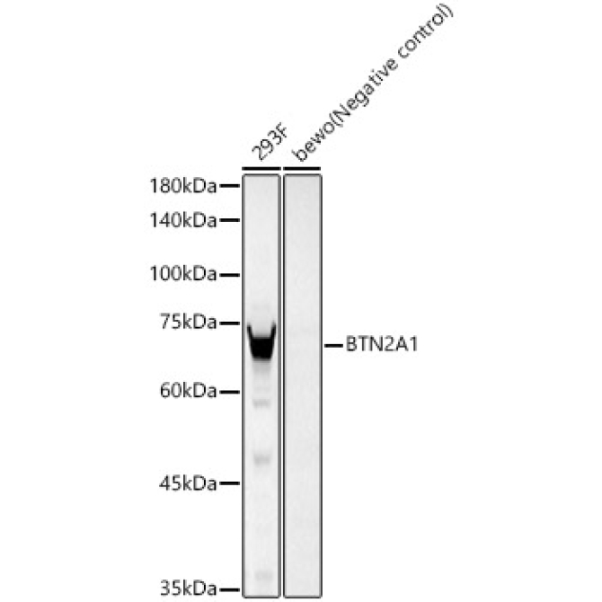 BTN2A1 Rabbit Monoclonal Antibody