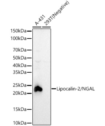 Lipocalin-2/NGAL Rabbit Monoclonal Antibody