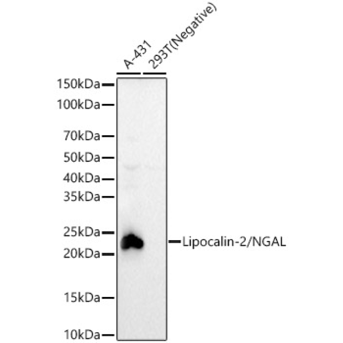 Lipocalin-2/NGAL Rabbit Monoclonal Antibody