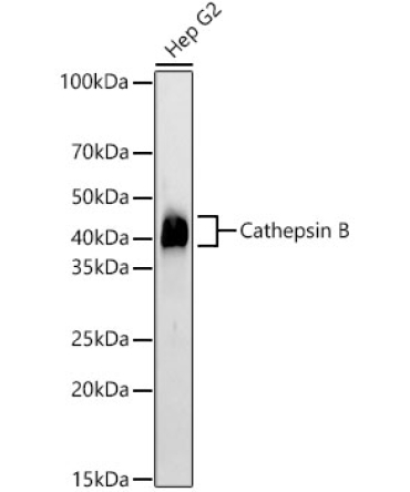 Cathepsin B Rabbit Monoclonal Antibody