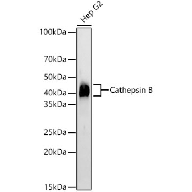 Cathepsin B Rabbit Monoclonal Antibody
