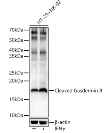 Cleaved Gasdermin B Rabbit Polyclonal Antibody