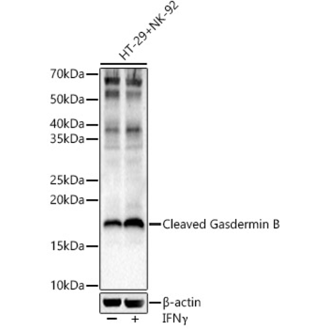 Cleaved Gasdermin B Rabbit Polyclonal Antibody