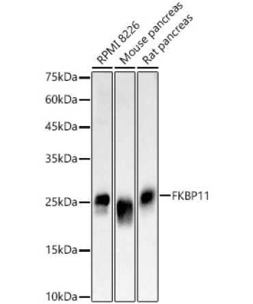 FKBP11 Rabbit Polyclonal Antibody