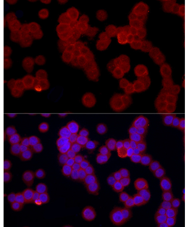 FPR2 Rabbit Polyclonal Antibody
