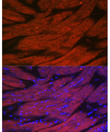 CACNA1S Rabbit Polyclonal Antibody