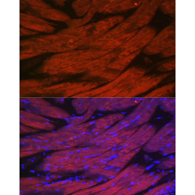 CACNA1S Rabbit Polyclonal Antibody