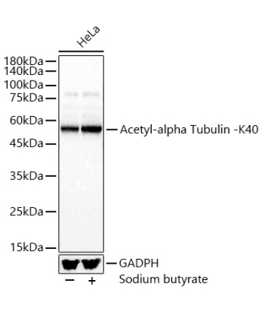 Acetyl-alpha Tubulin -K40 Rabbit Polyclonal Antibody