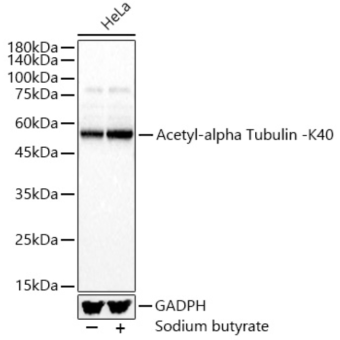 Acetyl-alpha Tubulin -K40 Rabbit Polyclonal Antibody