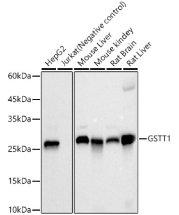 GSTT1 Rabbit Monoclonal Antibody