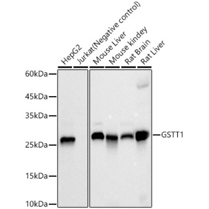GSTT1 Rabbit Monoclonal Antibody