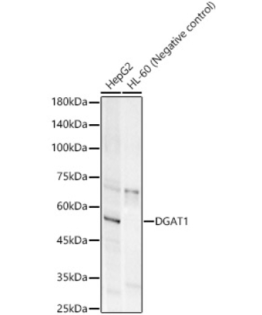 DGAT1 Rabbit Monoclonal Antibody