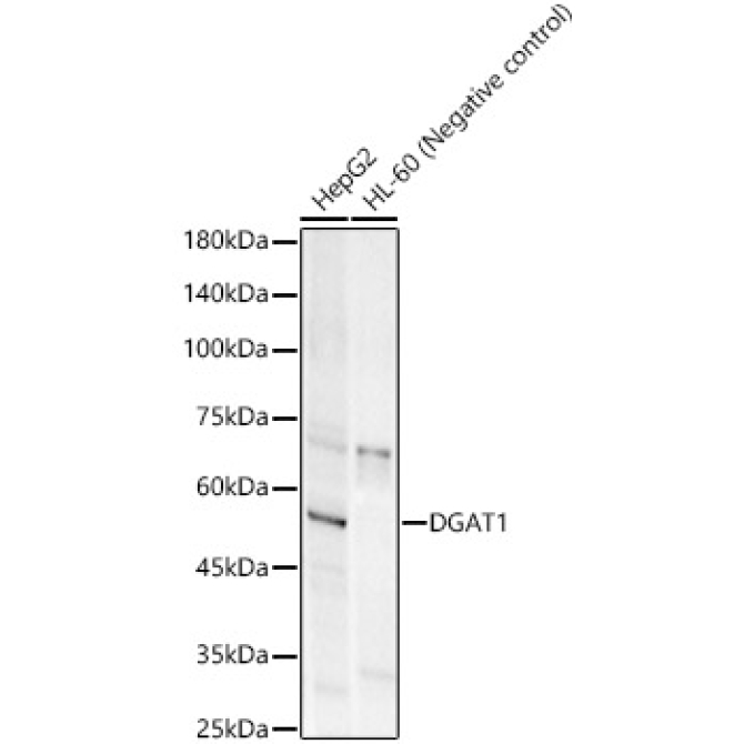 DGAT1 Rabbit Monoclonal Antibody