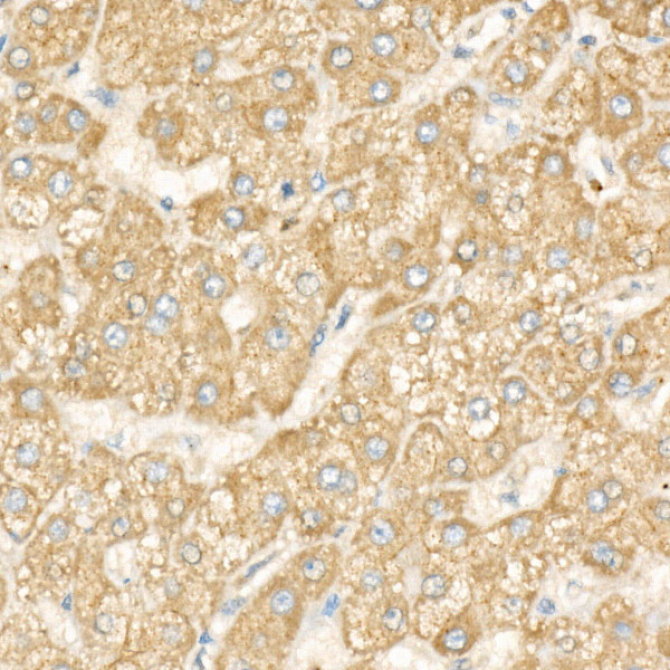 DGAT1 Rabbit Monoclonal Antibody