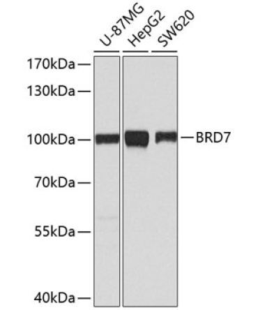 BRD7 Rabbit Polyclonal Antibody [KO Validated]