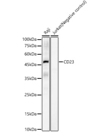 CD23 Rabbit Monoclonal Antibody
