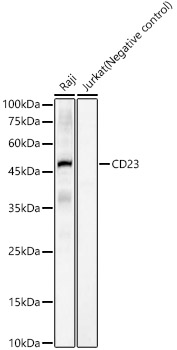 CD23 Rabbit Monoclonal Antibody