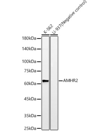 AMHR2 Rabbit Monoclonal Antibody