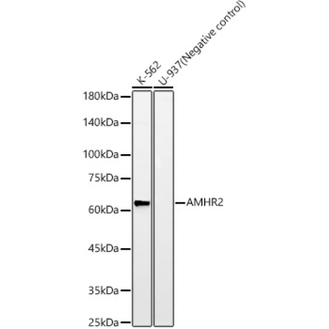 AMHR2 Rabbit Monoclonal Antibody