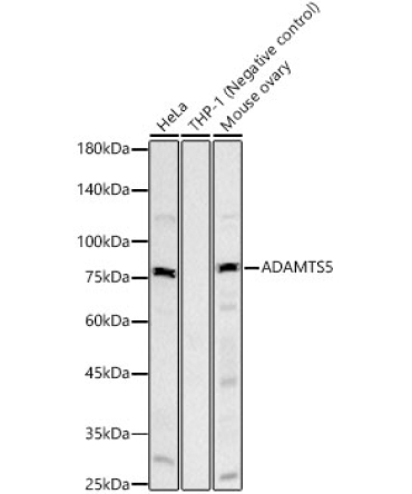 ADAMTS5 Rabbit Monoclonal Antibody