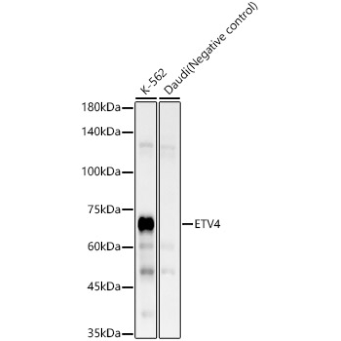 ETV4 Rabbit Monoclonal Antibody