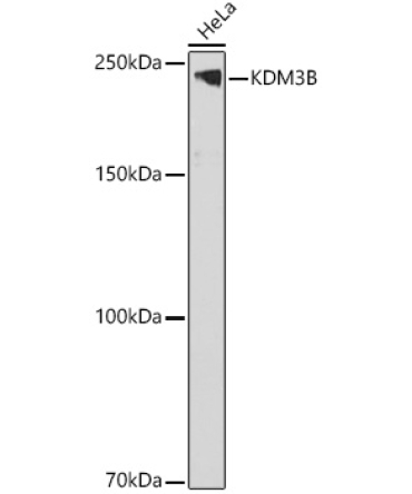 KDM3B Rabbit Polyclonal Antibody
