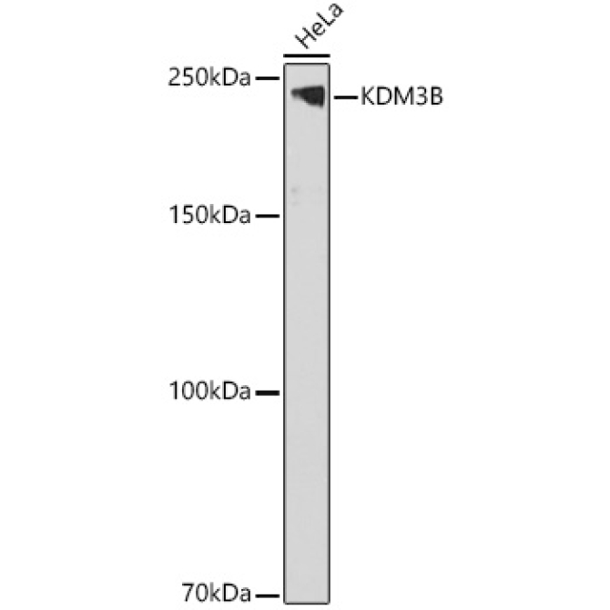 KDM3B Rabbit Polyclonal Antibody