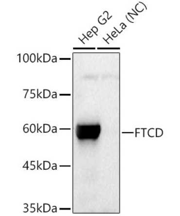 FTCD Rabbit PolyMonoclonal Antibody?